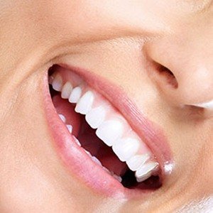 Zähne bleichen Charvat