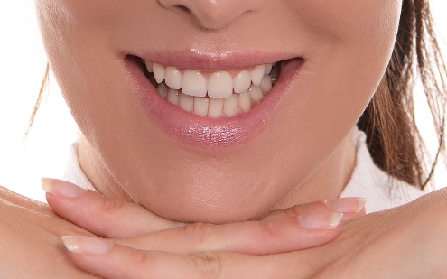 Patientenfall: Zähne nach der Behandlung mit Kronen